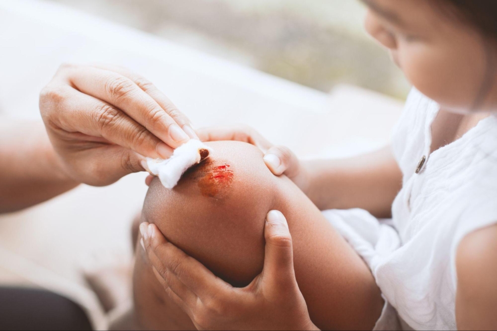 日常生活中,大人或小朋友難免會遇到意外受傷