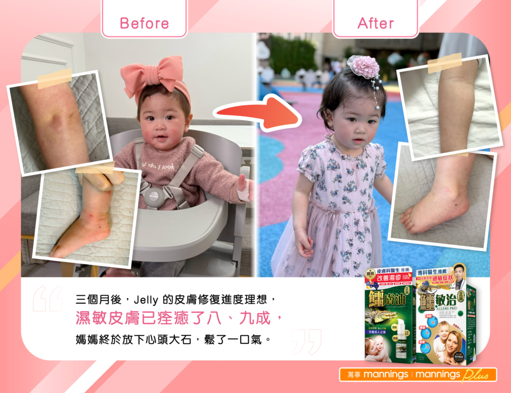 Jelly的舊患位置不但成功「收水埋口」,更沒有再出現擴散跡象。