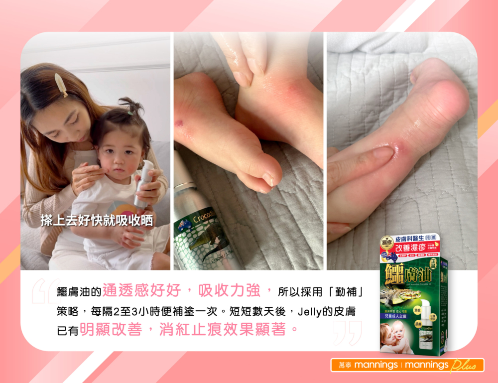 在媽媽群組的口碑推薦下,Jelly媽媽接觸到一款澳洲製造的「正品鱷膚油」 。