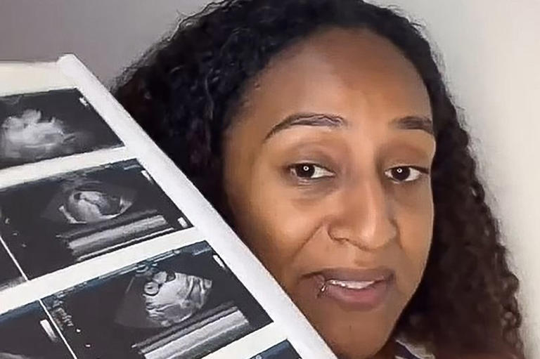 「異期復孕」意指女性在懷孕後仍能排卵，並在數天或數周後再次受孕