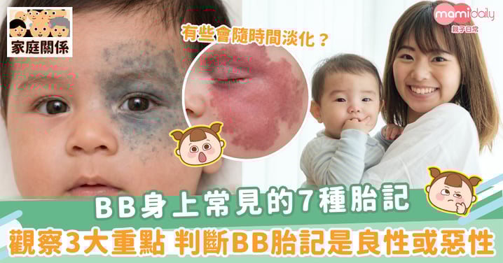 【辨認胎記】BB身上常見的7種胎記 觀察3大重點 判斷BB胎記是良性或惡性