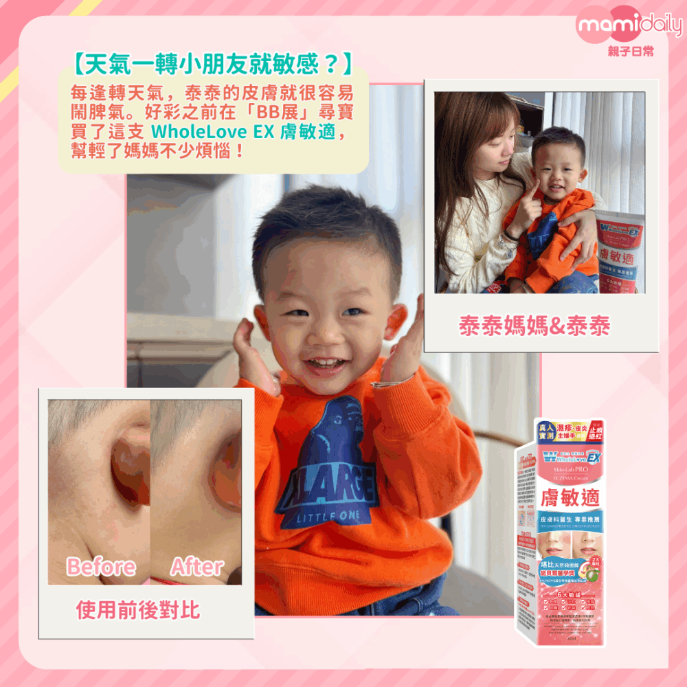 親身試過，大約 5 分鐘小朋友的㾗癢改善了不少，也不再狂抓，媽媽也鬆了一口氣。