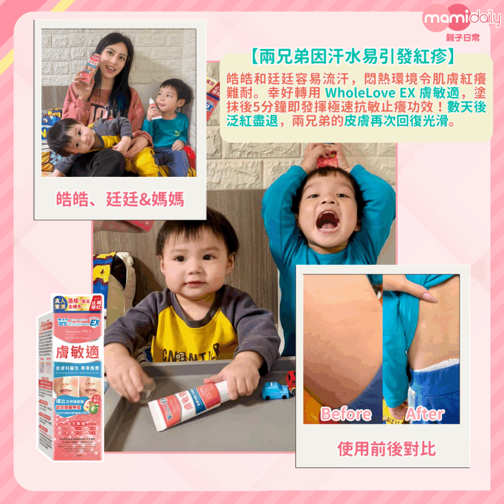 兩兄弟用了幾天，不但紅印消退，皮膚更重現無瑕白滑。成功幫媽媽解決爆汗敏感的煩惱！