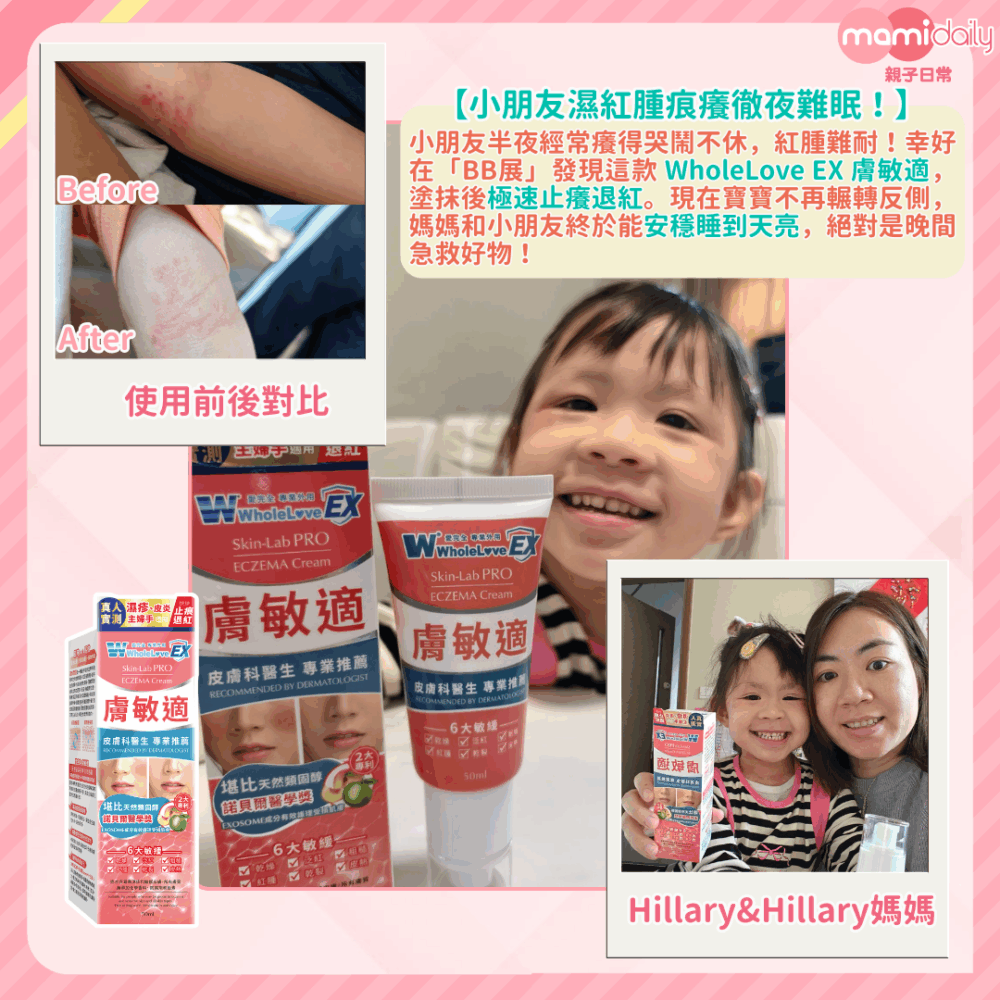 最近在「BB展」留意到這款WholeLove EX膚敏適，Hillary表示使用時終於沒有痛感，也很快消腫止痕。