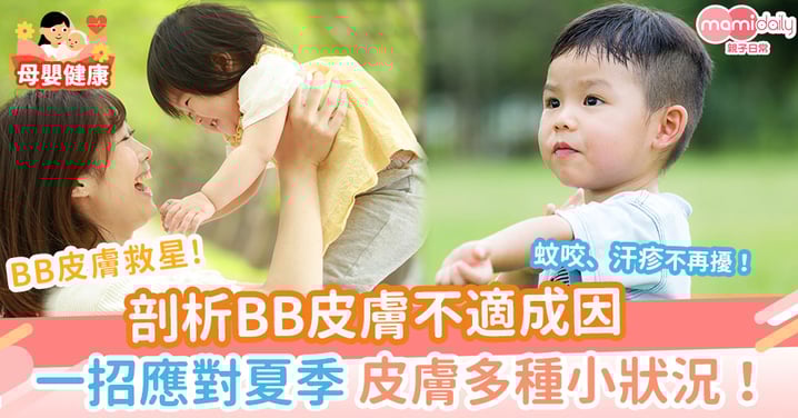 【BB皮膚救星】剖析BB皮膚不適成因 一招應對夏季BB皮膚多種小狀況!蚊咬、汗疹不再擾!