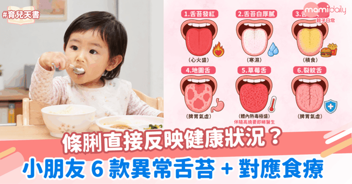條脷反映健康狀況？小朋友 6 款異常舌苔 + 對應食療