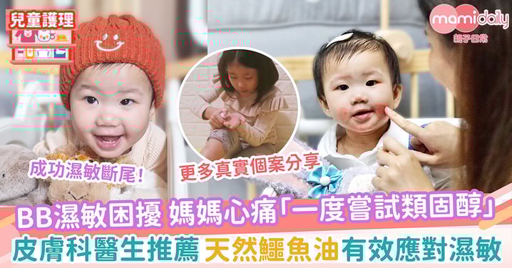 BB皮膚濕敏告急!真實媽媽個案分享「天然鱷魚油」助BB成功「濕敏斷尾」!