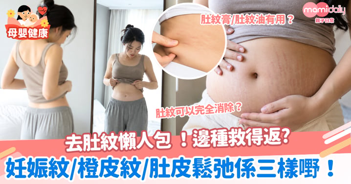 【去肚紋懶人包】妊娠紋、橙皮紋、肚皮鬆弛係三樣嘢!邊啲救得返、邊啲只能淡化?